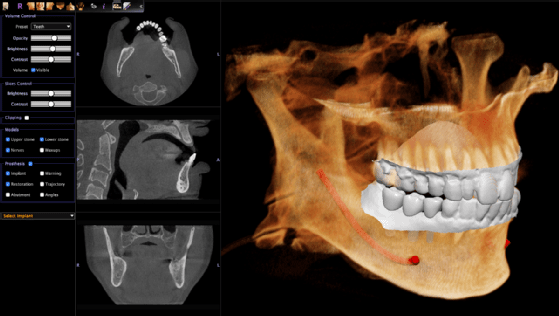 Anatomage updates its cloud platform to support viewing of 3D medical imaging.